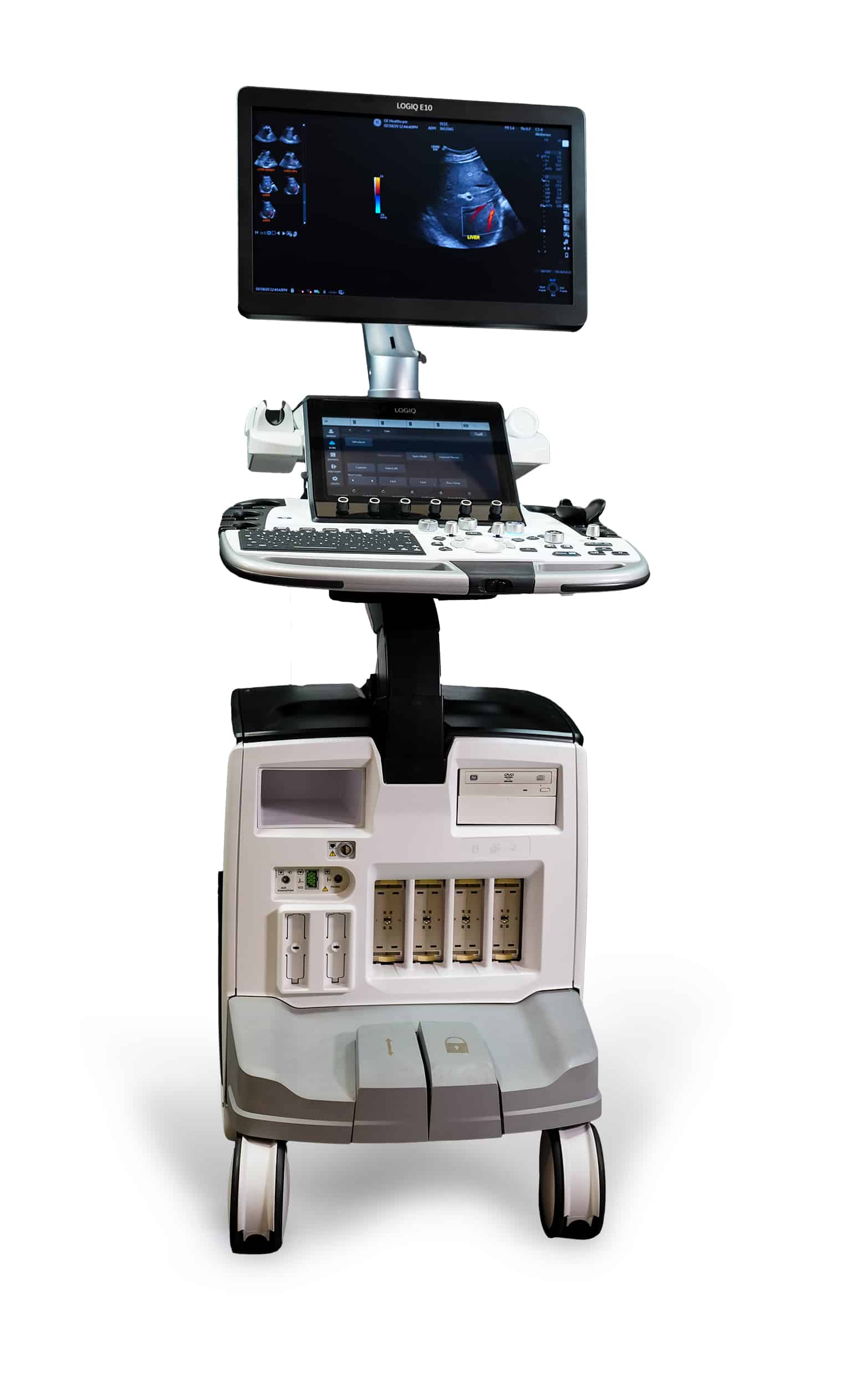 New & Used Portable Ultrasound Machines for Sale | UDS